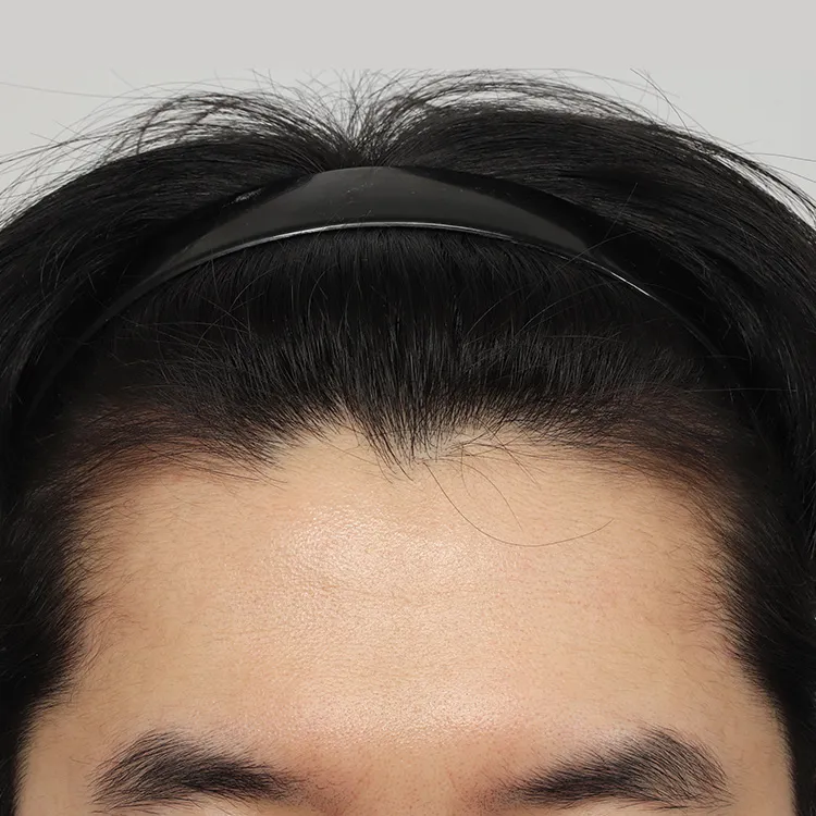 치료 전